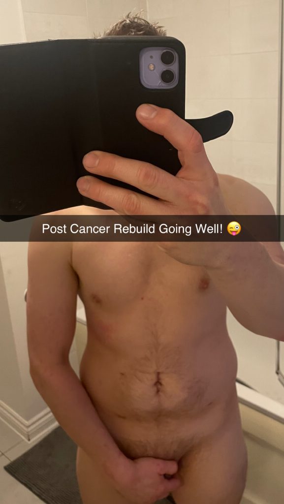 How I now look after surgery, rebuilding my body, adding on muscle.