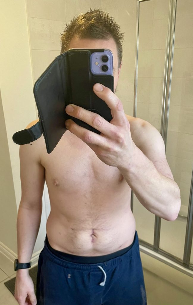 How I looked after Cancer surgery before rebuilding my body